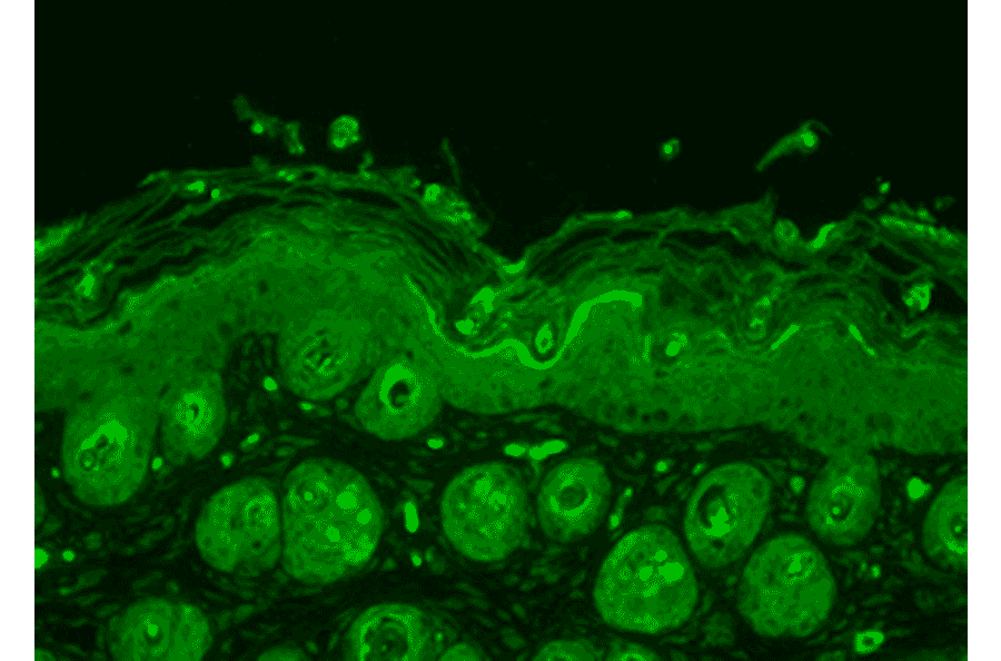 Immunohistochemistry - Anti-Ubiquitin Antibody (A305108) - Antibodies.com