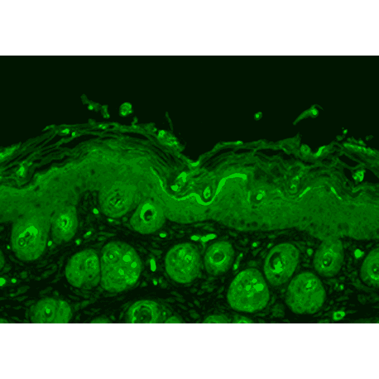 Immunohistochemistry - Anti-Ubiquitin Antibody (A305108) - Antibodies.com
