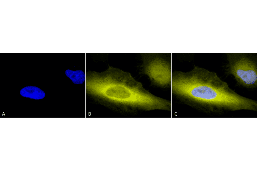 Immunocytochemistry/Immunofluorescence - Anti-Ubiquitin Antibody (A305108) - Antibodies.com