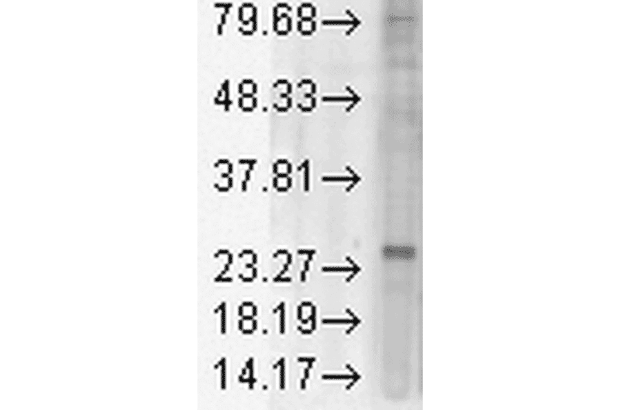 Western Blot - Anti-KDEL Receptor Antibody [KR-10] (A305109) - Antibodies.com