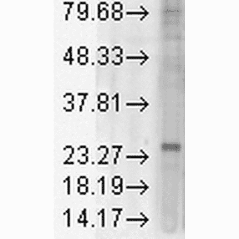 Western Blot - Anti-KDEL Receptor Antibody [KR-10] (A305109) - Antibodies.com