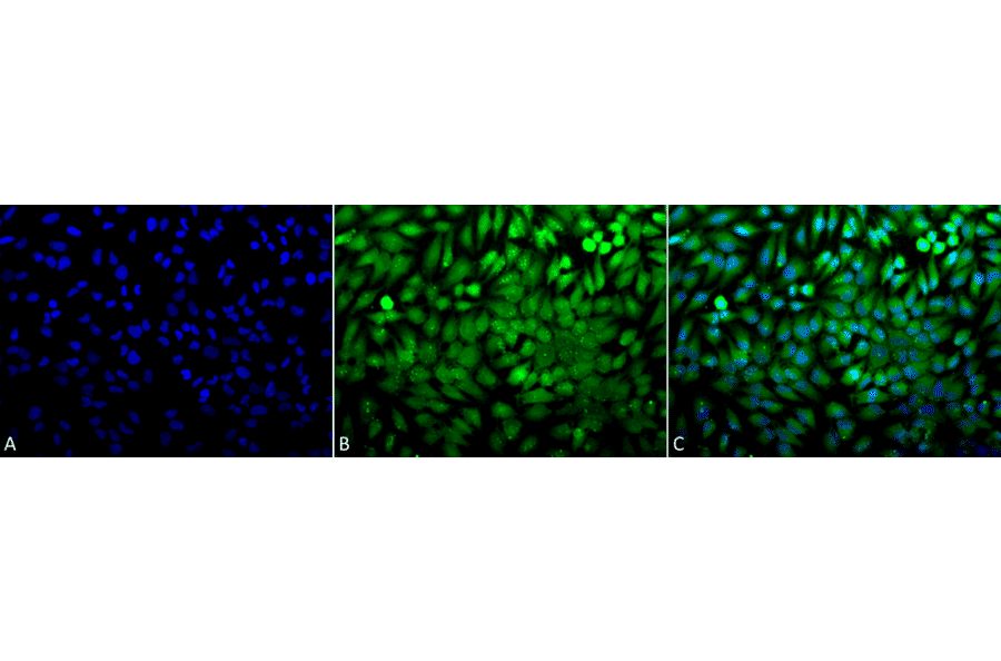 Immunocytochemistry/Immunofluorescence - Anti-p38 alpha / MAPK14 Antibody (A305111) - Antibodies.com