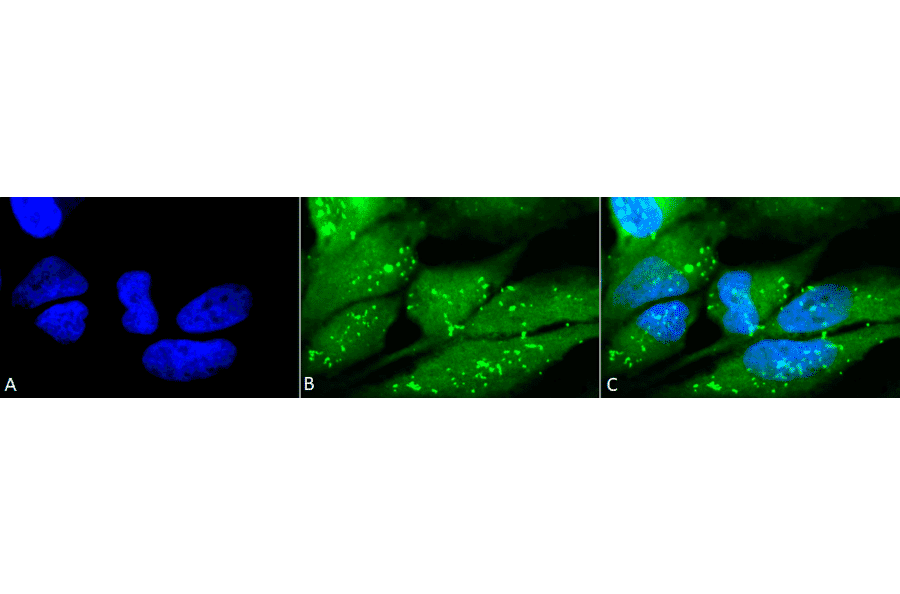 Immunocytochemistry/Immunofluorescence - Anti-p38 alpha / MAPK14 Antibody (A305111) - Antibodies.com