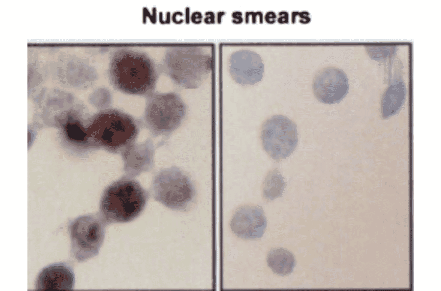 Immunocytochemistry/Immunofluorescence - Anti-HSP70 Antibody [BB70] (A305113) - Antibodies.com