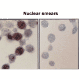 Immunocytochemistry/Immunofluorescence - Anti-HSP70 Antibody [BB70] (A305113) - Antibodies.com