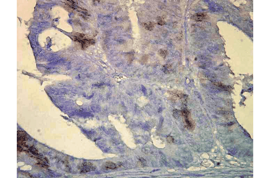 Immunohistochemistry - Anti-HSP70 Antibody [BB70] (A305113) - Antibodies.com