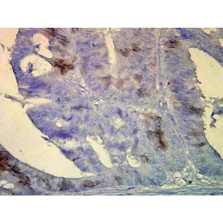 Immunohistochemistry - Anti-HSP70 Antibody [BB70] (A305113) - Antibodies.com