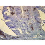 Immunohistochemistry - Anti-HSP70 Antibody [BB70] (A305113) - Antibodies.com