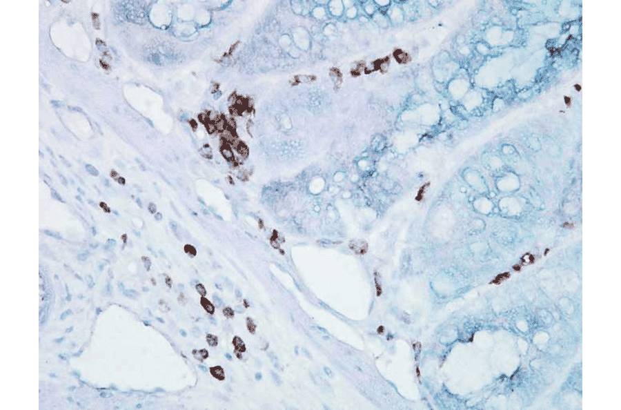 Immunohistochemistry - Anti-HSP70 Antibody [BB70] (A305113) - Antibodies.com