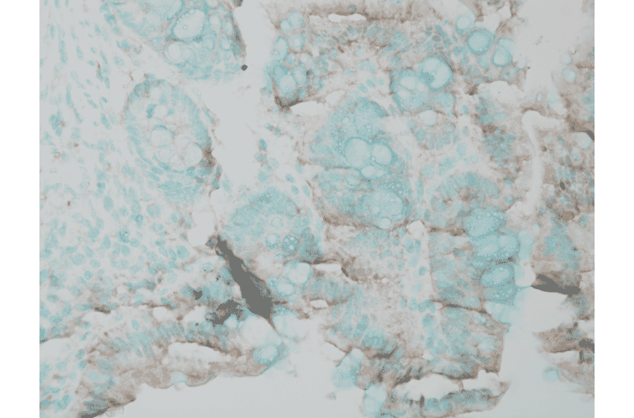 Immunohistochemistry - Anti-ERK1 Antibody (A305114) - Antibodies.com