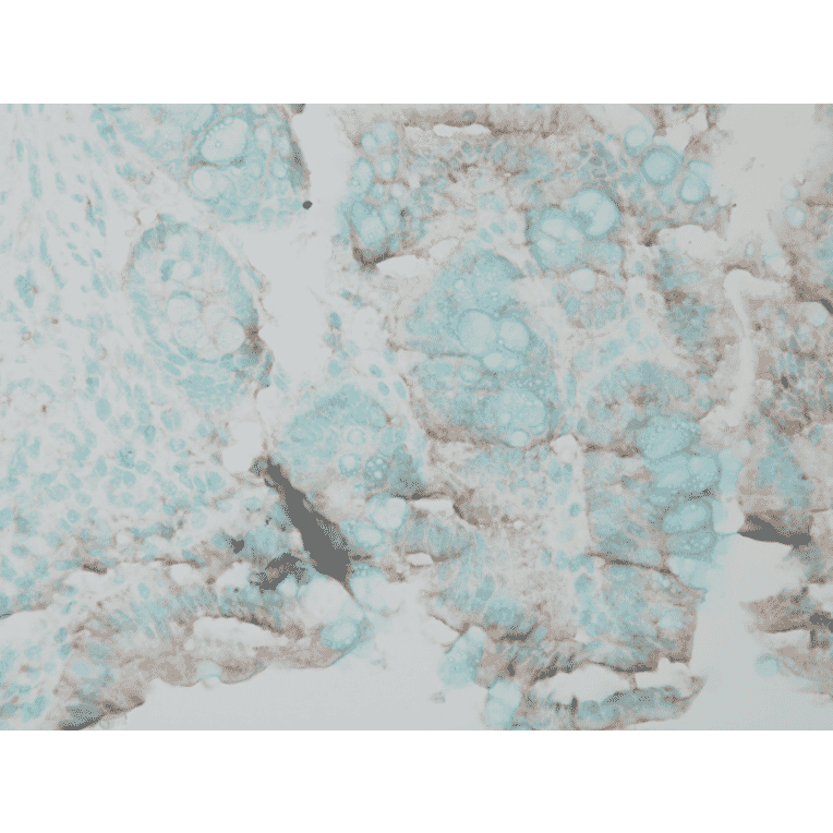 Immunohistochemistry - Anti-ERK1 Antibody (A305114) - Antibodies.com