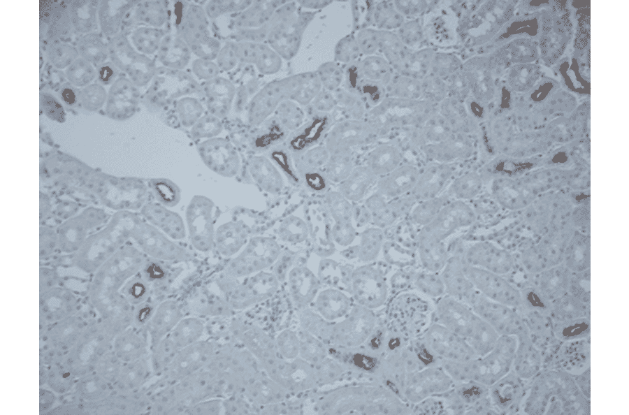 Immunohistochemistry - Anti-SLC12A3 Antibody (A305115) - Antibodies.com