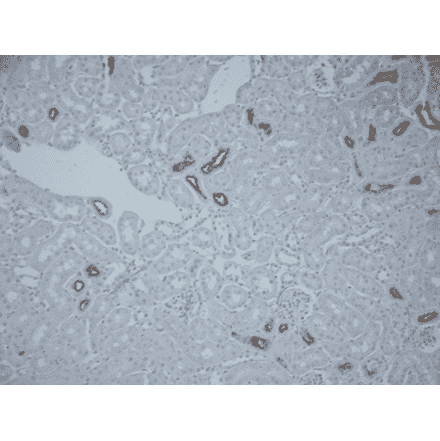 Immunohistochemistry - Anti-SLC12A3 Antibody (A305115) - Antibodies.com