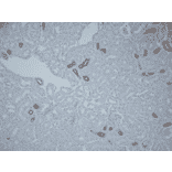 Immunohistochemistry - Anti-SLC12A3 Antibody (A305115) - Antibodies.com
