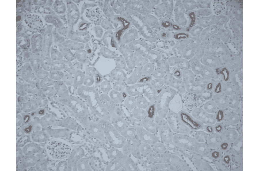 Immunohistochemistry - Anti-SLC12A3 Antibody (A305115) - Antibodies.com