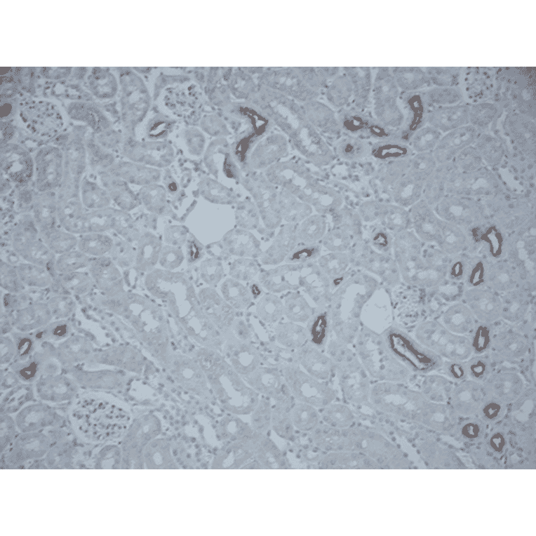 Immunohistochemistry - Anti-SLC12A3 Antibody (A305115) - Antibodies.com