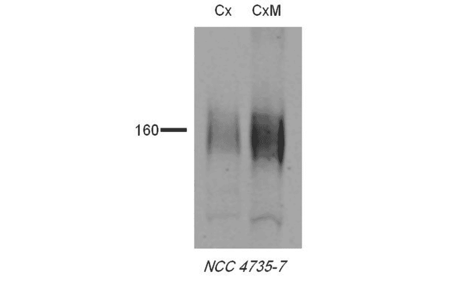 Western Blot - Anti-SLC12A3 Antibody (A305115) - Antibodies.com