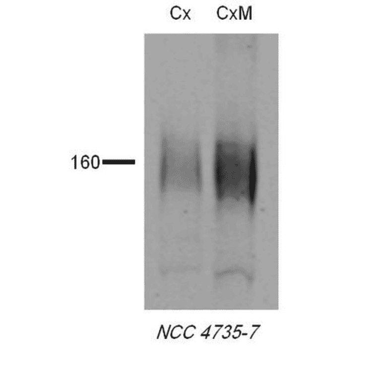 Western Blot - Anti-SLC12A3 Antibody (A305115) - Antibodies.com