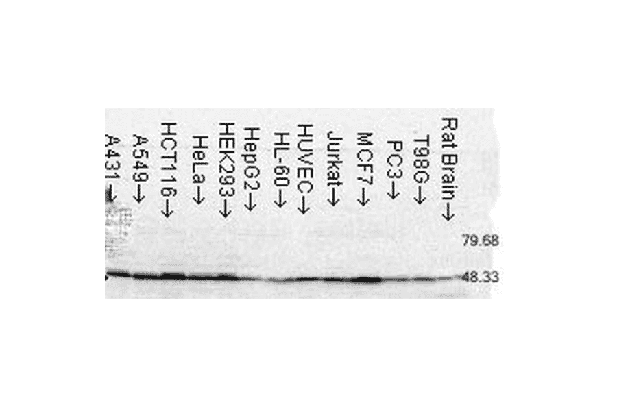 Western Blot - Anti-FKBP52 Antibody [Hi52C] (A305118) - Antibodies.com