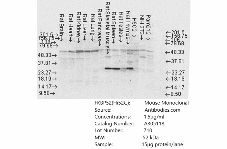 Western Blot - Anti-FKBP52 Antibody [Hi52C] (A305118) - Antibodies.com