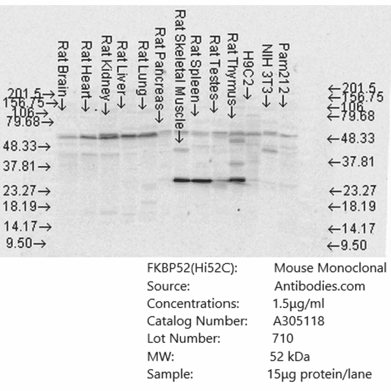 Western Blot - Anti-FKBP52 Antibody [Hi52C] (A305118) - Antibodies.com