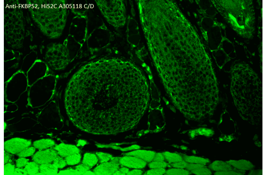Immunohistochemistry - Anti-FKBP52 Antibody [Hi52C] (A305118) - Antibodies.com