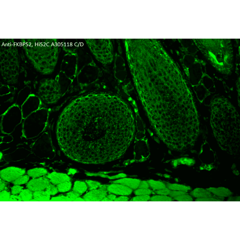 Immunohistochemistry - Anti-FKBP52 Antibody [Hi52C] (A305118) - Antibodies.com