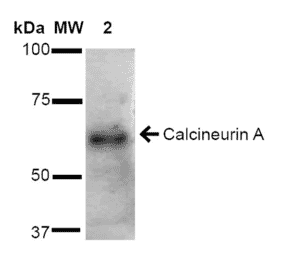 Western Blot - Anti-Calcineurin A Antibody (A305119) - Antibodies.com