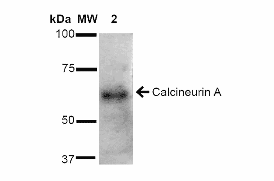 Western Blot - Anti-Calcineurin A Antibody (A305119) - Antibodies.com