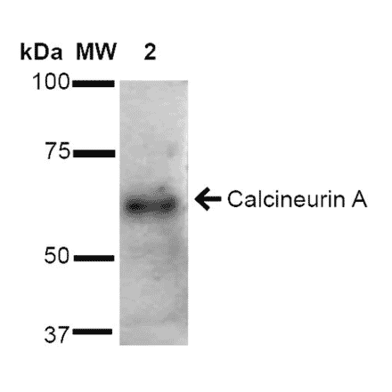 Western Blot - Anti-Calcineurin A Antibody (A305119) - Antibodies.com