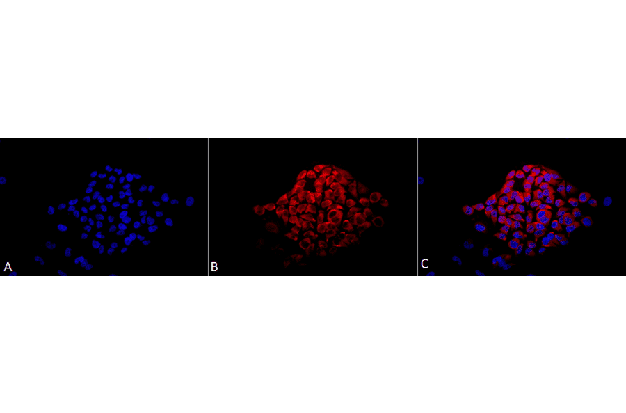 Immunocytochemistry/Immunofluorescence - Anti-Calcineurin A Antibody (A305119) - Antibodies.com
