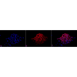 Immunocytochemistry/Immunofluorescence - Anti-Calcineurin A Antibody (A305119) - Antibodies.com