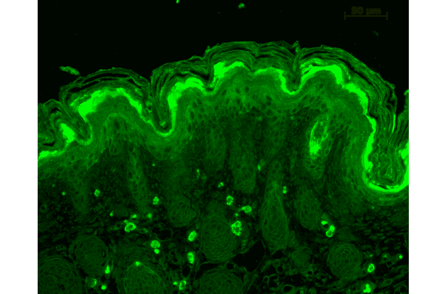 Immunohistochemistry - Anti-Calcineurin A Antibody (A305119) - Antibodies.com