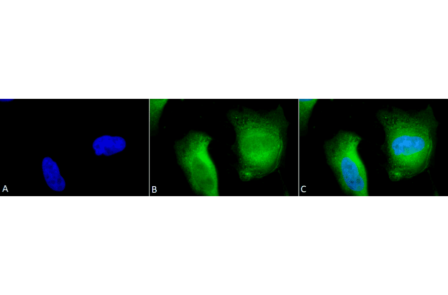 Immunocytochemistry/Immunofluorescence - Anti-Calcineurin A Antibody (A305119) - Antibodies.com