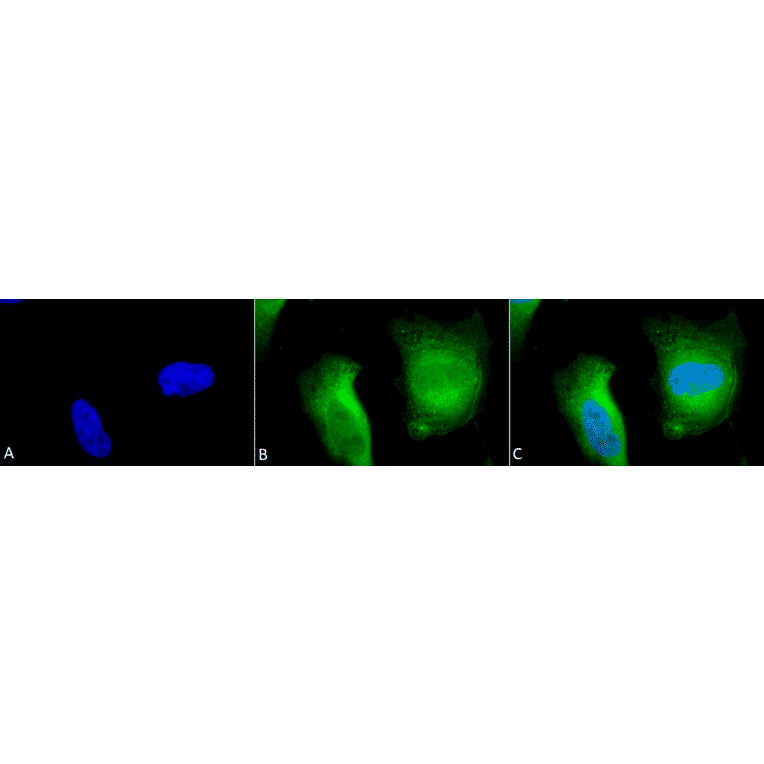 Immunocytochemistry/Immunofluorescence - Anti-Calcineurin A Antibody (A305119) - Antibodies.com