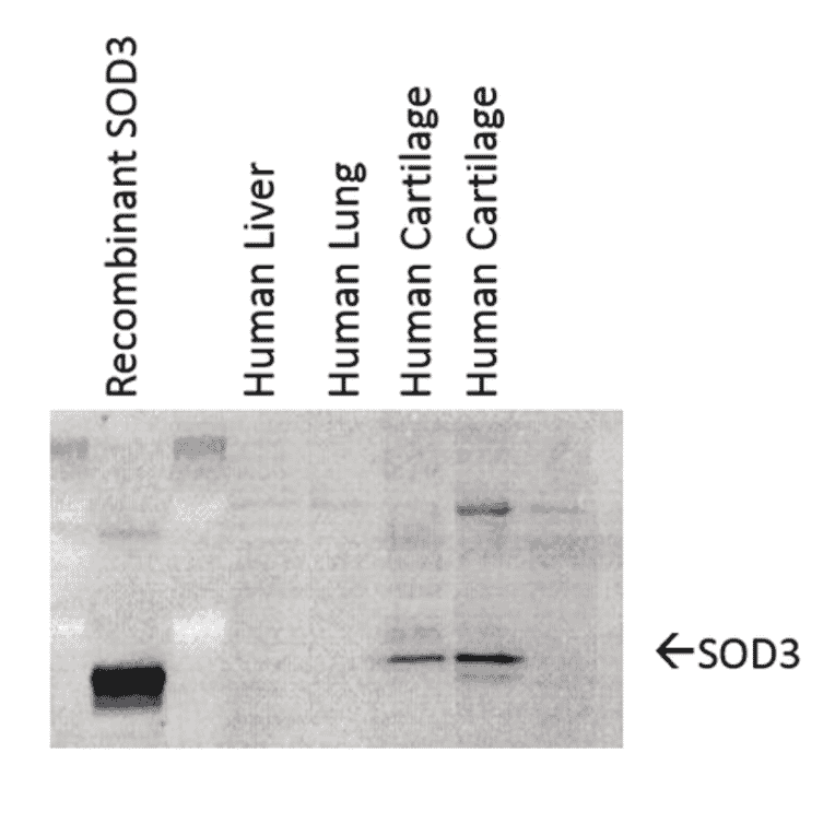 Western Blot - Anti-Superoxide Dismutase 3 / EC-SOD Antibody [4GG11G6] (A305121) - Antibodies.com