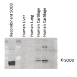 Western Blot - Anti-Superoxide Dismutase 3 / EC-SOD Antibody [4GG11G6] (A305121) - Antibodies.com