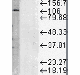 Western Blot - Anti-LAMP1 Antibody [Ly1C6] (A305123) - Antibodies.com