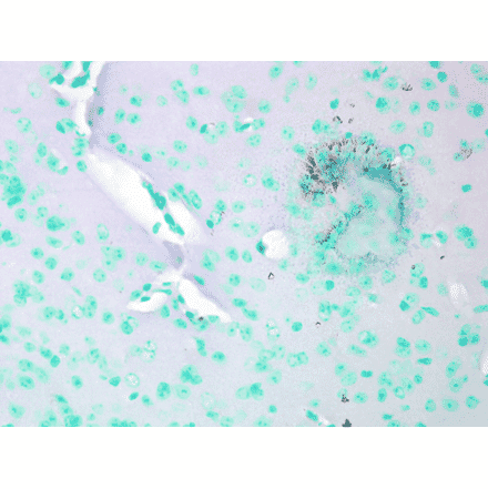 Immunohistochemistry - Anti-CACNA1C Antibody [S57] (A305124) - Antibodies.com