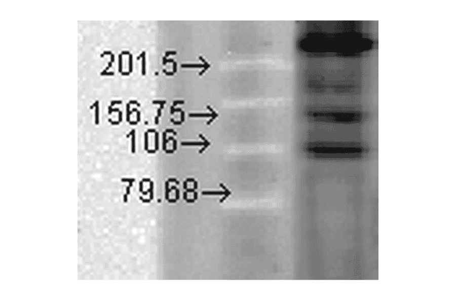 Western Blot - Anti-CACNA1C Antibody [S57] (A305124) - Antibodies.com