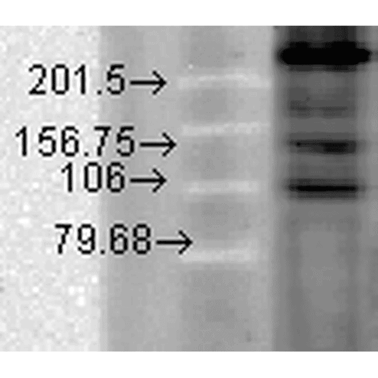 Western Blot - Anti-CACNA1C Antibody [S57] (A305124) - Antibodies.com