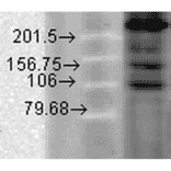 Western Blot - Anti-CACNA1C Antibody [S57] (A305124) - Antibodies.com