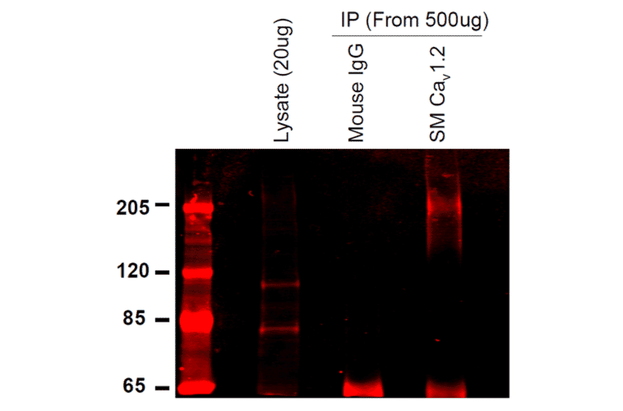 Immunoprecipitation - Anti-CACNA1C Antibody [S57] (A305124) - Antibodies.com