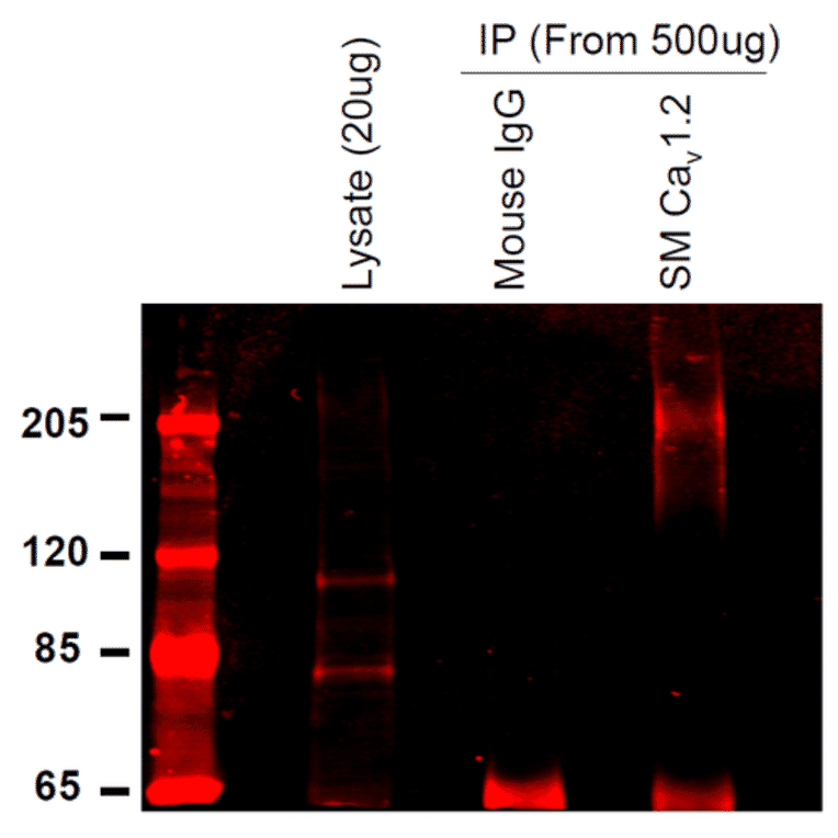 Immunoprecipitation - Anti-CACNA1C Antibody [S57] (A305124) - Antibodies.com