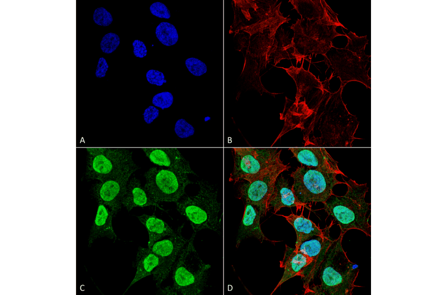 Immunocytochemistry/Immunofluorescence - Anti-CACNA1C Antibody [S57] (A305124) - Antibodies.com