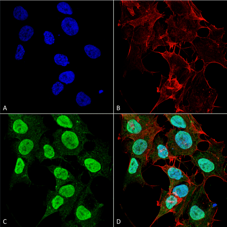 Immunocytochemistry/Immunofluorescence - Anti-CACNA1C Antibody [S57] (A305124) - Antibodies.com