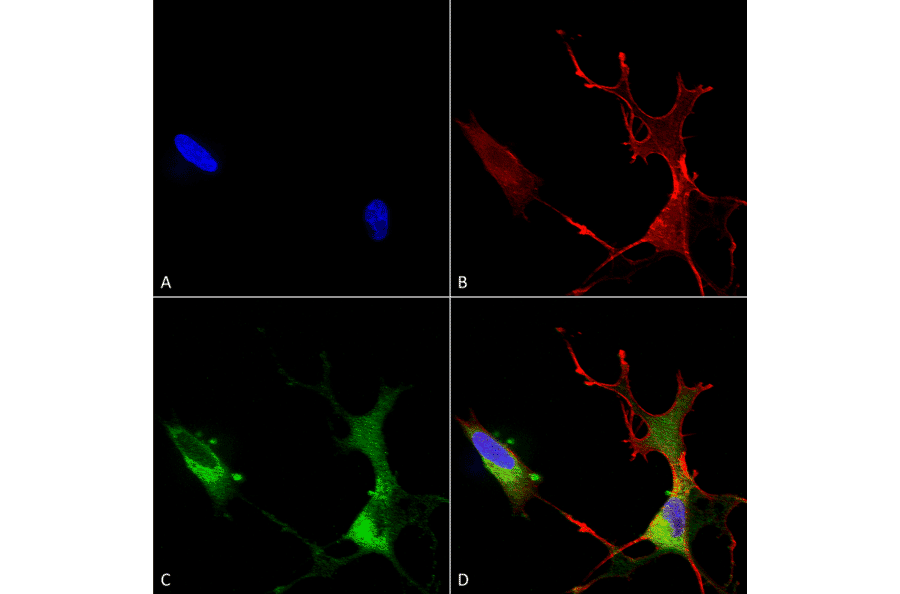 Immunocytochemistry/Immunofluorescence - Anti-CACNA1C Antibody [S57] (A305124) - Antibodies.com