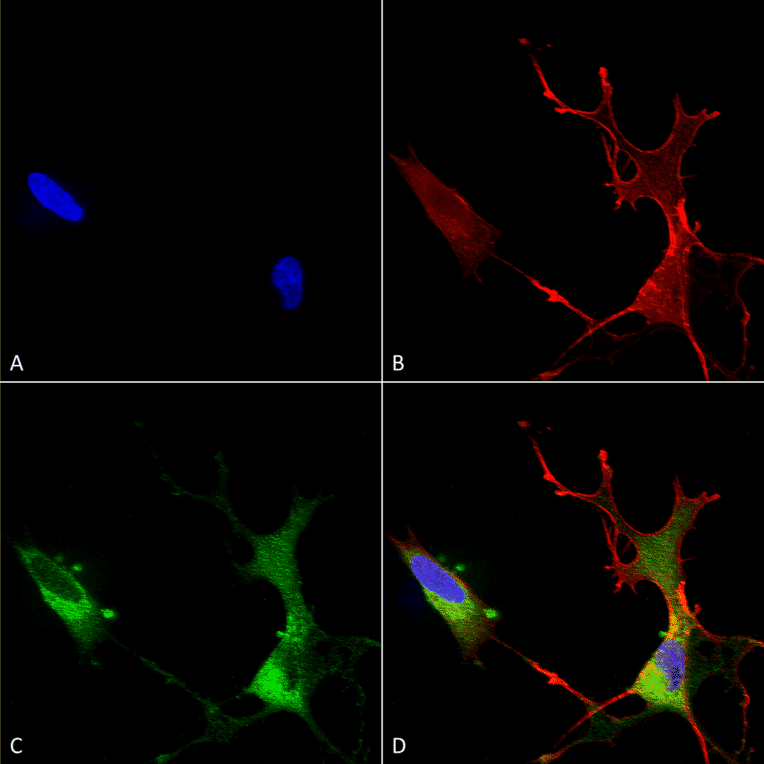 Immunocytochemistry/Immunofluorescence - Anti-CACNA1C Antibody [S57] (A305124) - Antibodies.com