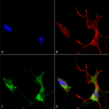 Immunocytochemistry/Immunofluorescence - Anti-CACNA1C Antibody [S57] (A305124) - Antibodies.com
