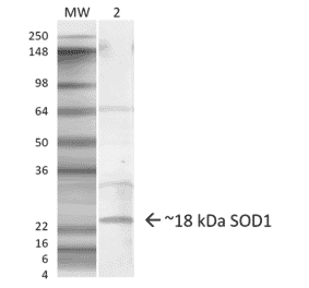 Western Blot - Anti-Superoxide Dismutase 1 Antibody (A305127) - Antibodies.com